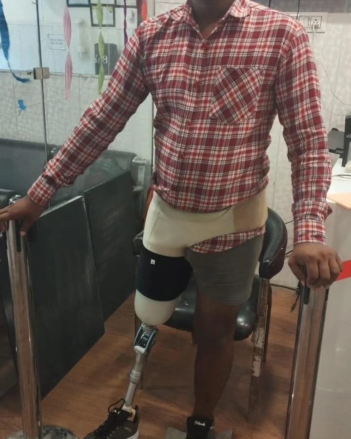 ARTIFICIAL LIMB